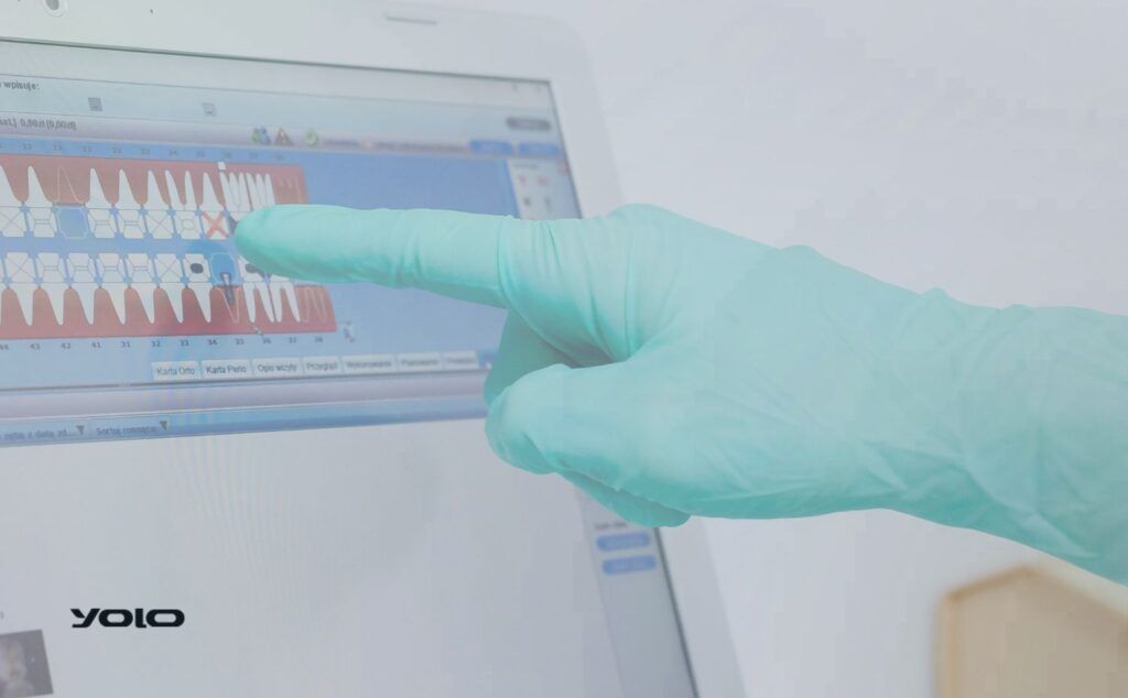 كيف يحقق نظام Yolo السحابي سيطرة مركزية شاملة على جميع الفروع؟